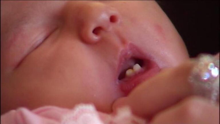 Baby Born With Teeth Spiritual Meaning: Unveiling Mysteries